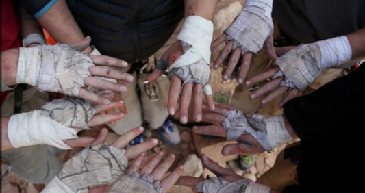 Do Rock Climbers Wrap Their Hands?